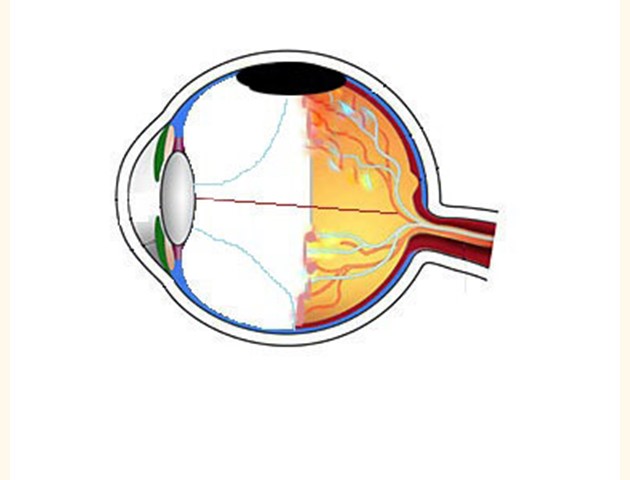 Prematuren retinopathie